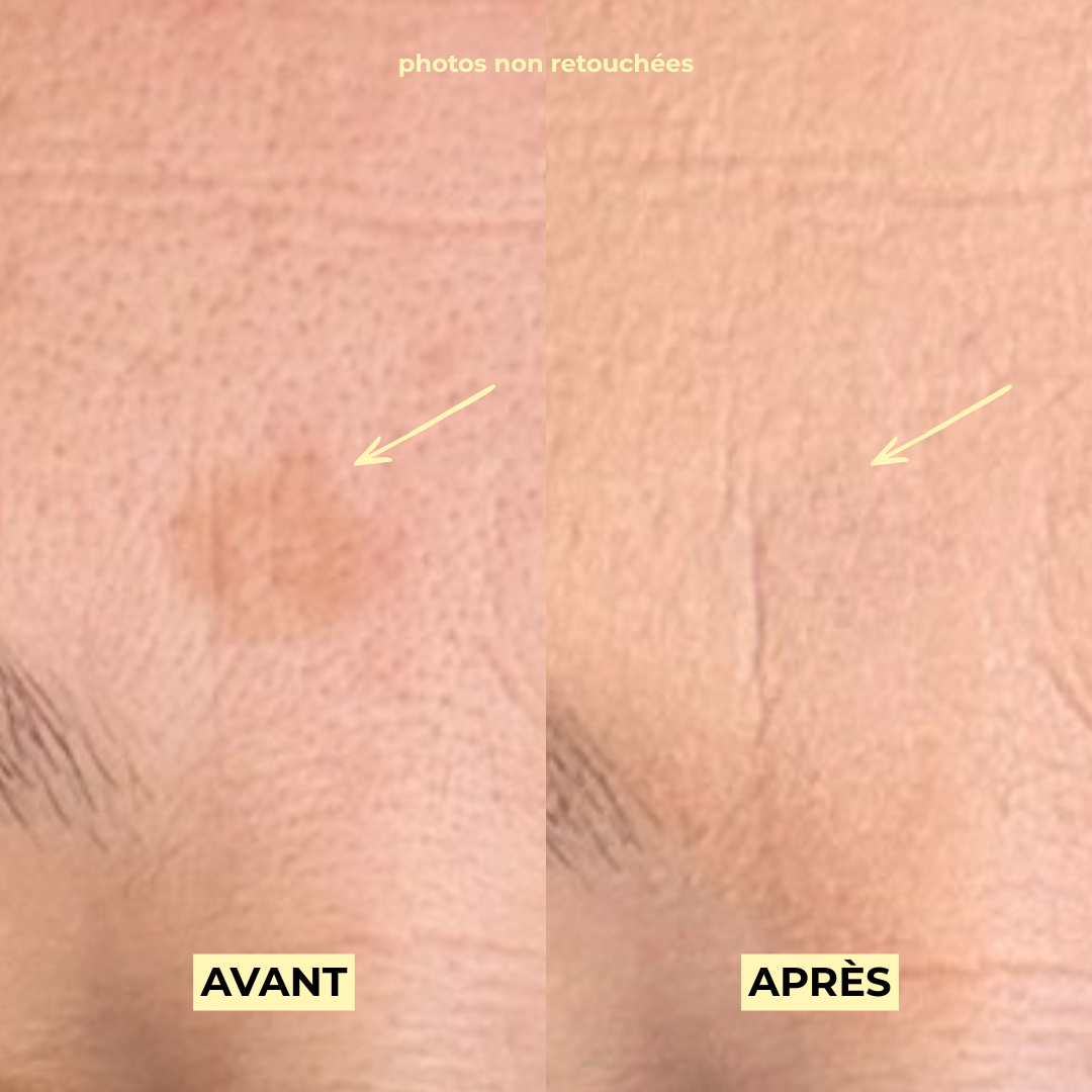 pomponne-rituel-anti-taches-teinte-bb-cr-me image 3